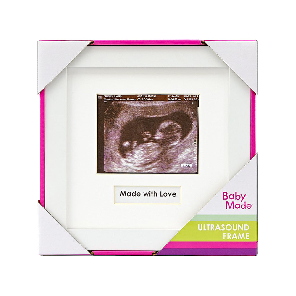 Scan Frame Baby Photo Frames